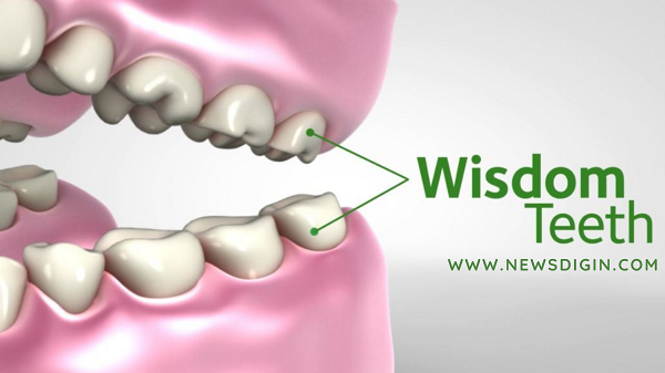 Wisdom Teeth Benefits
